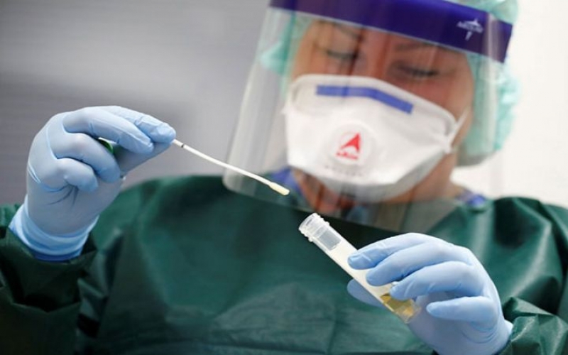 Azərbaycanda daha 1 178 nəfər koronavirusa yoluxub,  24 nəfər ölüb
